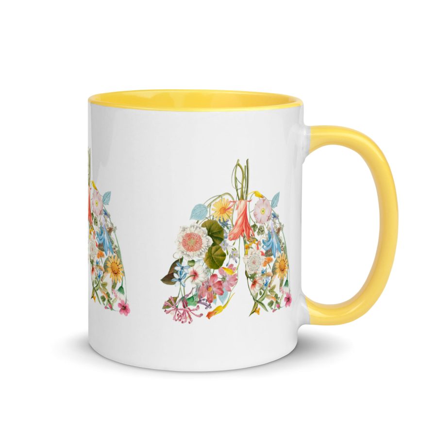 White Ceramic Mug With Color Inside Yellow 11Oz Right 629Afc019Bb25