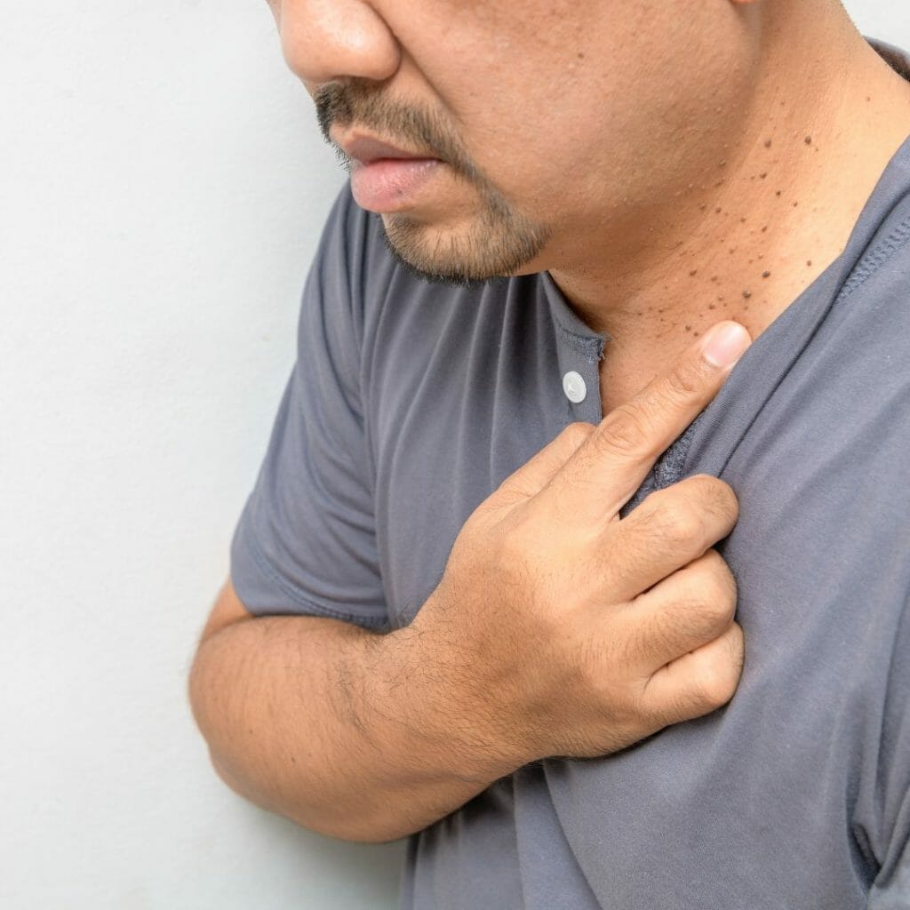 Melanoma Detection, Identification, And Treatment Option