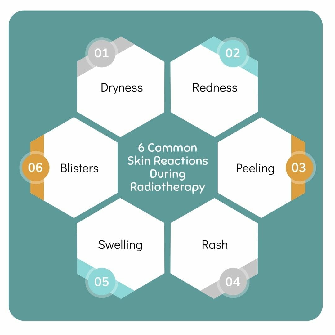 6 Common Skin Reactions During Radiotherapy