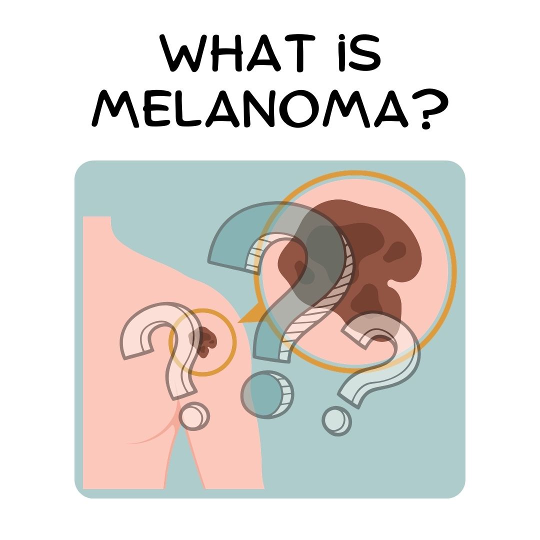 what is melanoma