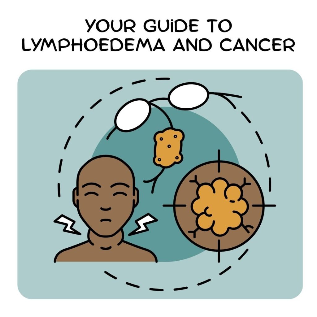 Your Guide to Lymphoedema and Cancer