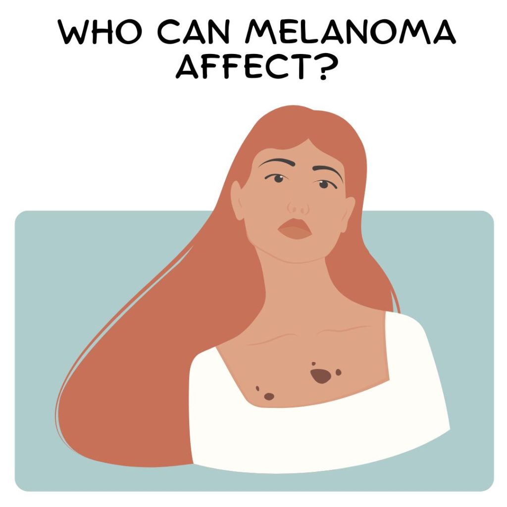 Who Can Melanoma Affect?