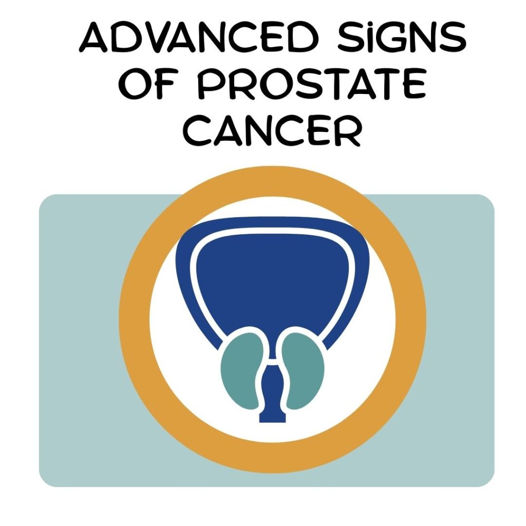 Advanced Signs of Prostate Cancer