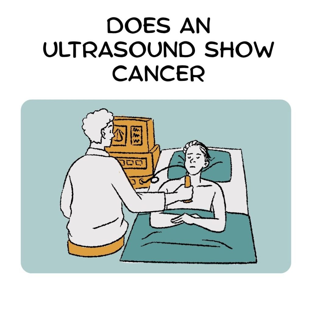 Does an Ultrasound Show Cancer