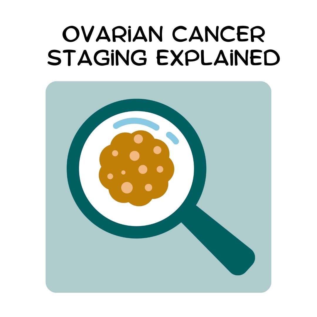 Ovarian Cancer Staging Explained