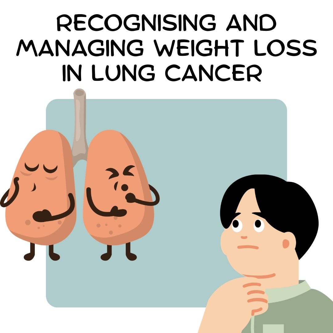 Recognising and managing weight loss in lung cancer