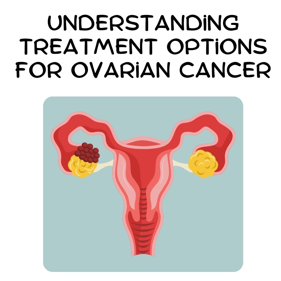 Treatment Options for Ovarian Cancer