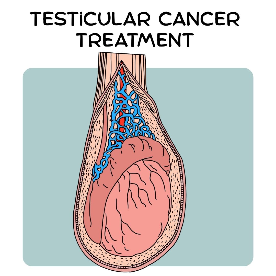 Your Guide to Testicular Cancer Treatment Options