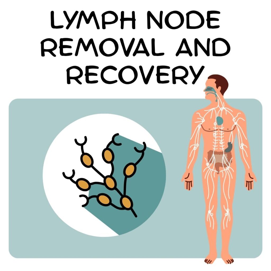 Lymph node removal and recovery