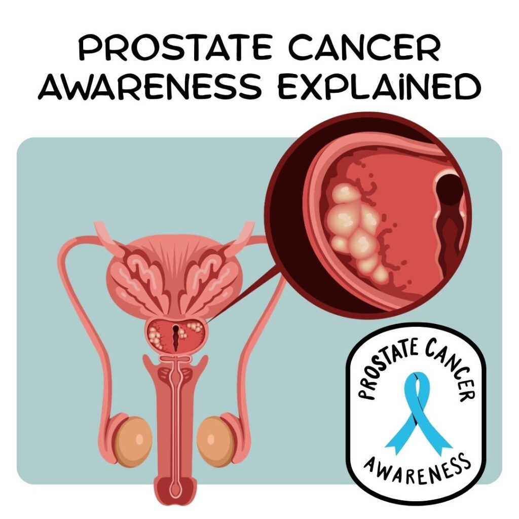 Prostate Cancer Awareness Explained