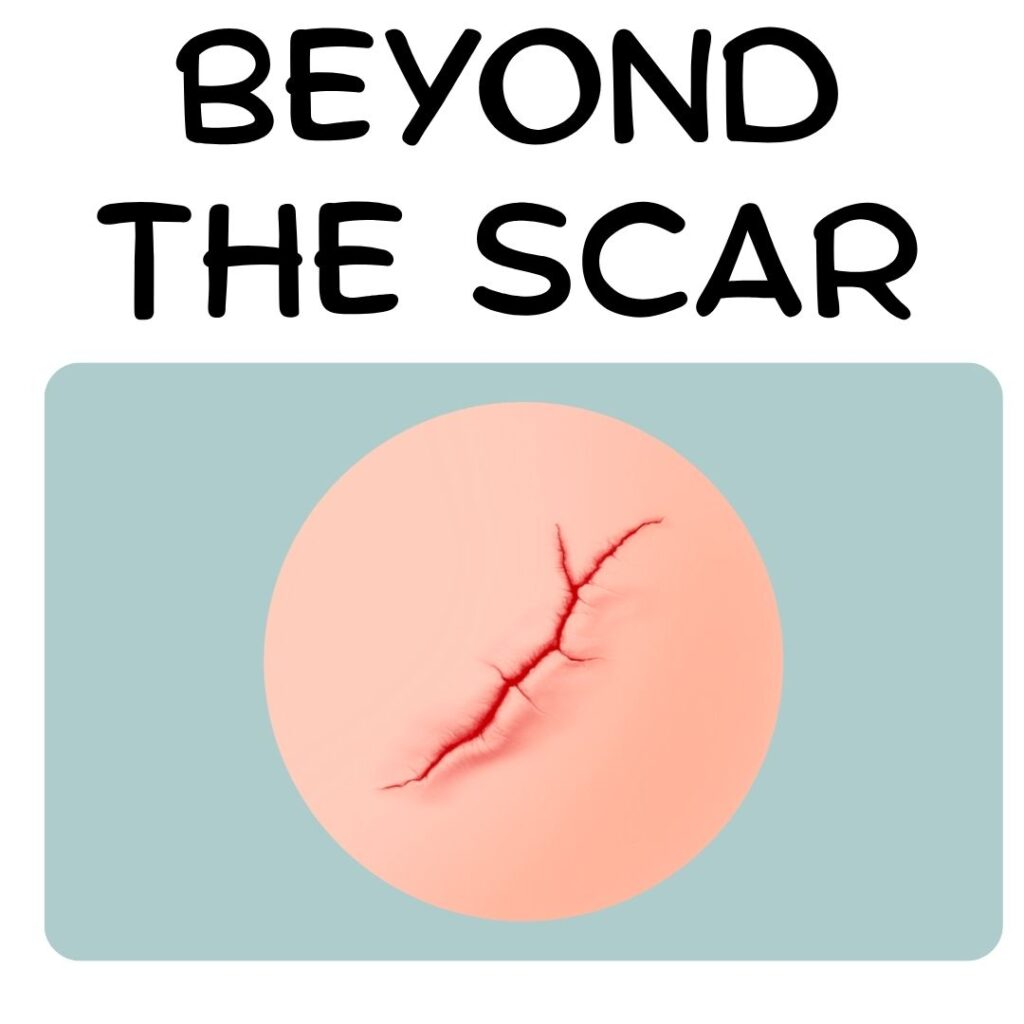 Beyond the Scar